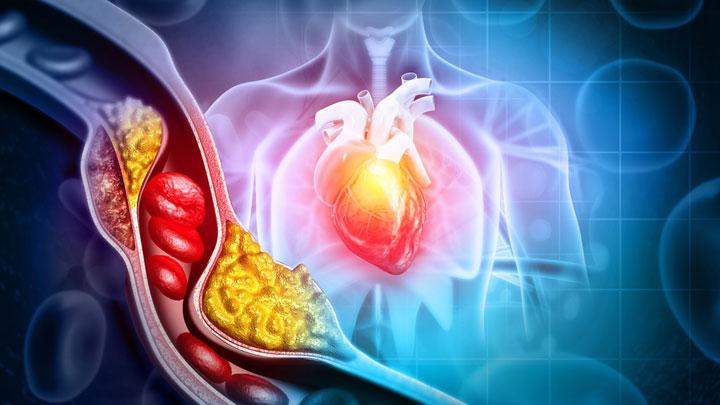 6 Minuman Herbal yang Bisa Menurunkan Kolesterol